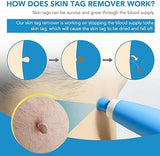 ✨ Acrochordon Skin Tag Remover Kit – 2-in-1 Fast & Painless Solution 🩹💖